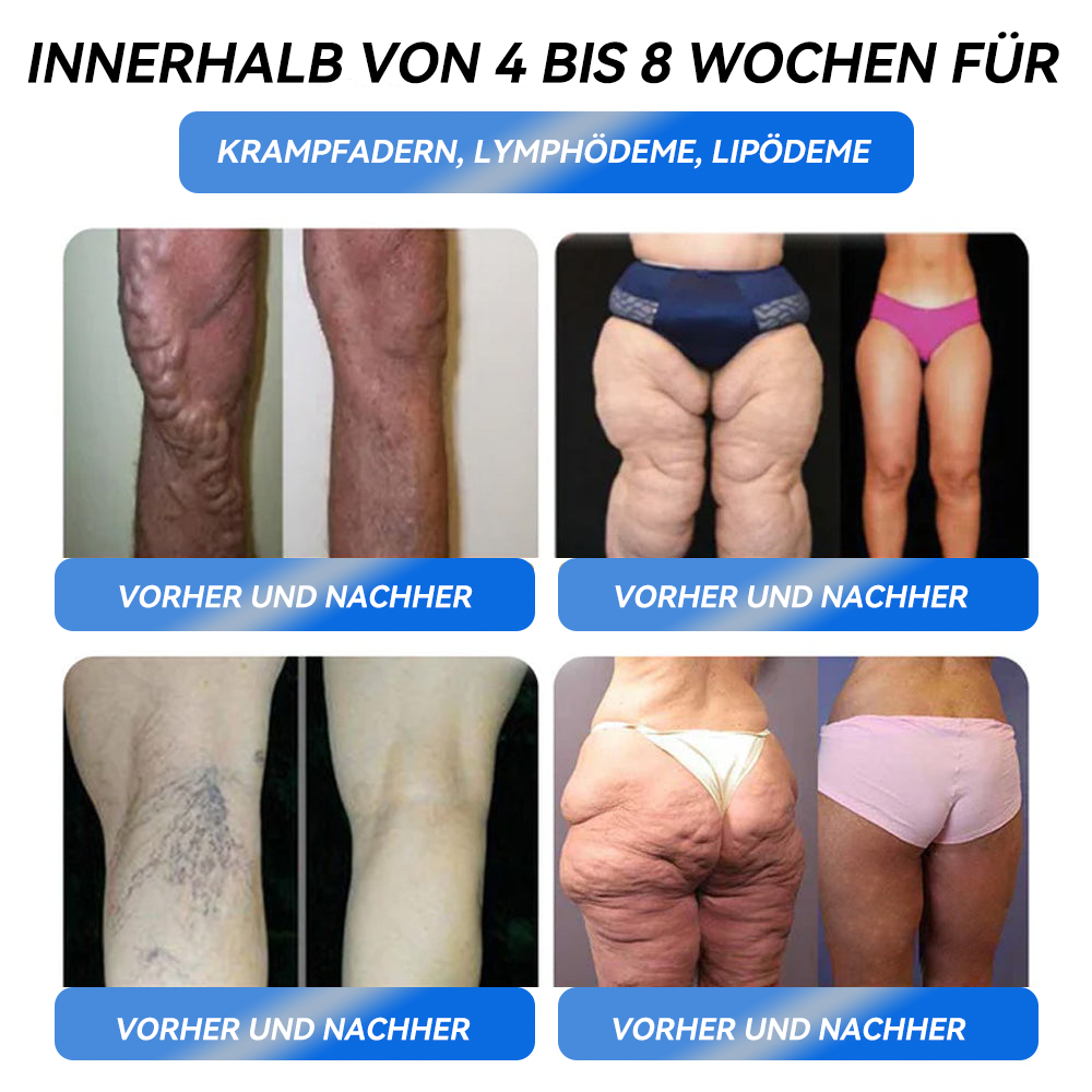 𝐈𝐅𝐌𝐀𝐆𝐈𝐂® 𝐆𝐋𝐏-𝟏 𝐏𝐫𝐨 𝐆𝐞𝐰𝐢𝐜𝐡𝐭𝐬𝐫𝐞𝐝𝐮𝐤𝐭𝐢𝐨𝐧𝐬-𝐎𝐫𝐚𝐥-𝐋ö𝐬𝐮𝐧𝐠-🍁💖