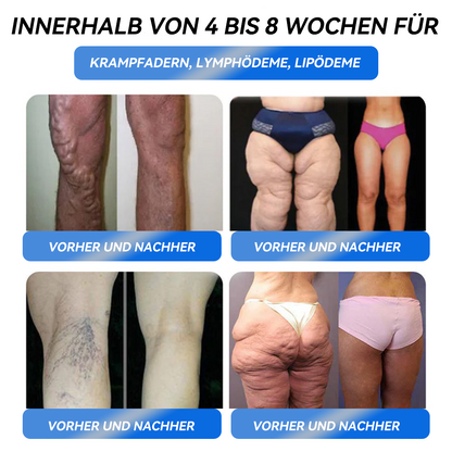 𝐈𝐅𝐌𝐀𝐆𝐈𝐂® 𝐆𝐋𝐏-𝟏 𝐏𝐫𝐨 𝐆𝐞𝐰𝐢𝐜𝐡𝐭𝐬𝐫𝐞𝐝𝐮𝐤𝐭𝐢𝐨𝐧𝐬-𝐎𝐫𝐚𝐥-𝐋ö𝐬𝐮𝐧𝐠-💐💖